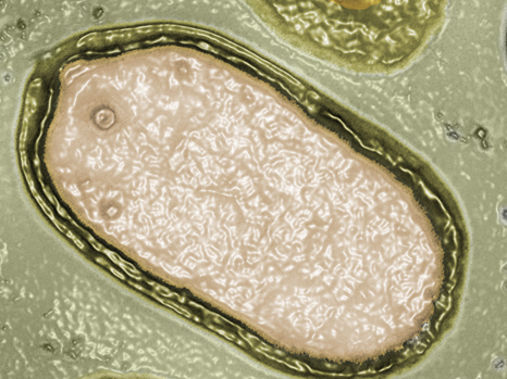 Pandoravirus salinus observé par microscopie électronique © IGS CNRS-AMU